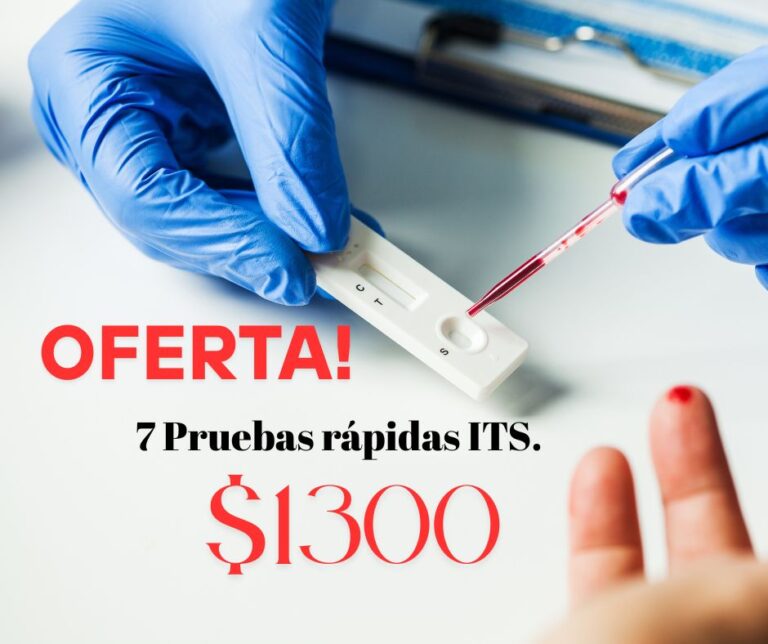 Prueba rápida VIH